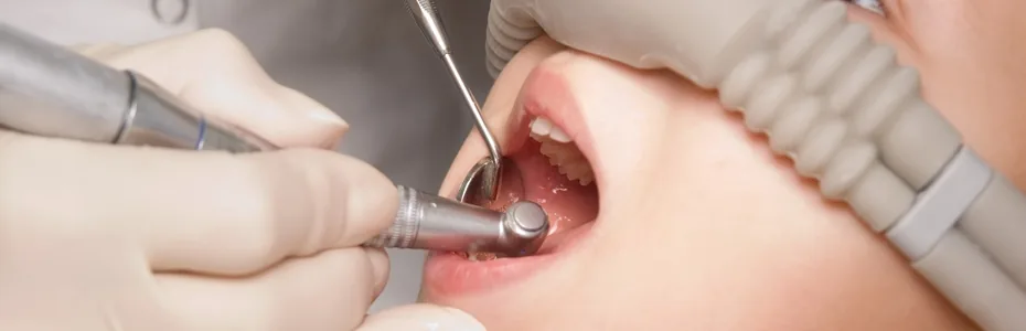 Behandlung mit Lachgas über eine Nasenmaske