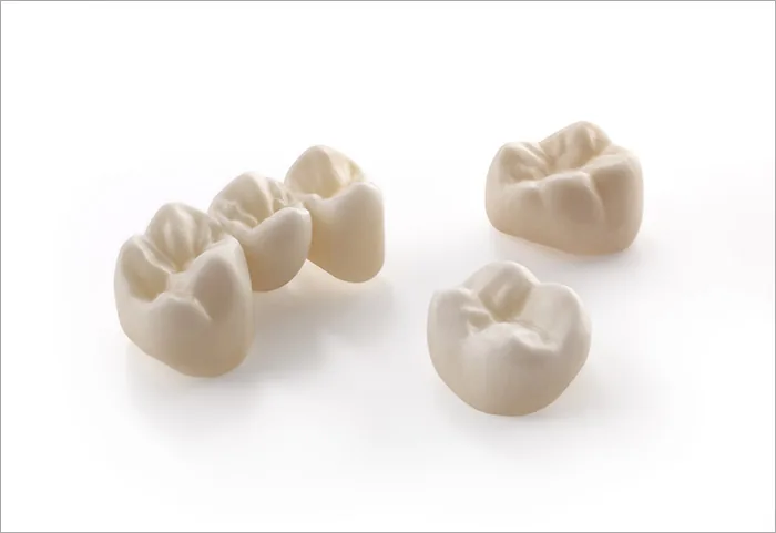 Vollkeramische Zirkonoxid-Kronen auf einem Modell